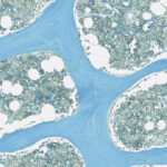 AllCells Bone Marrow