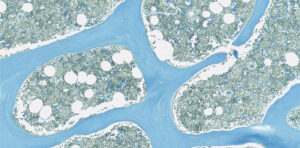 AllCells Bone Marrow